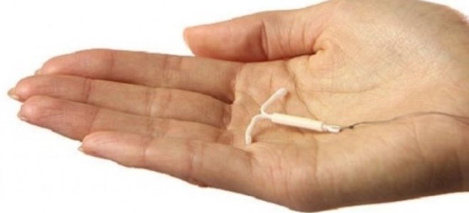 спираль противозачаточная